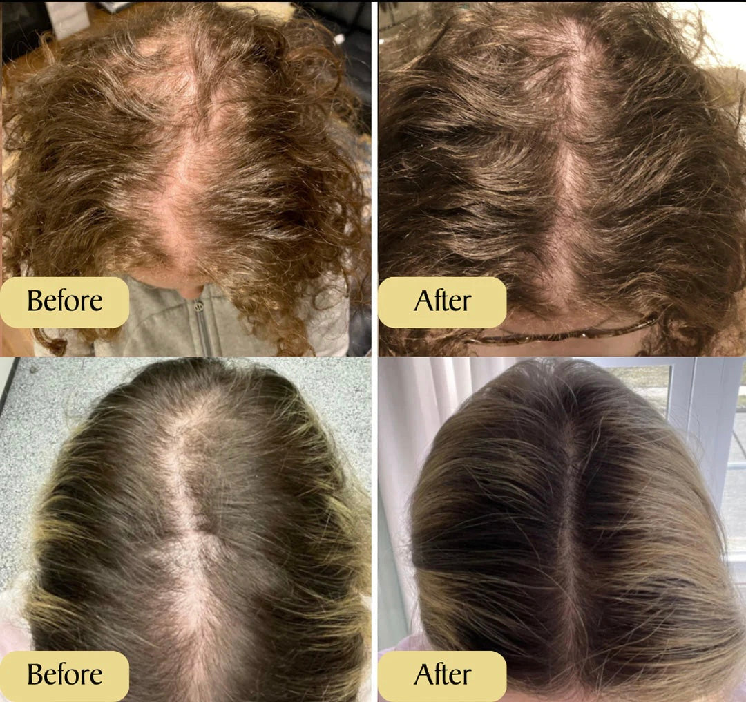 Vegan Haargroei Serum - Alleen Vandaag 1+1 gratis!