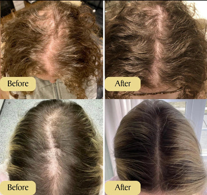 Vegan Haargroei Serum - Alleen Vandaag 1+1 gratis!