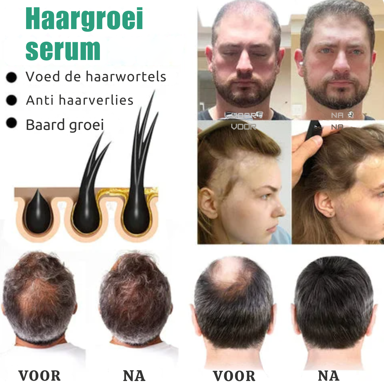 Vegan Haargroei serum - 1+1 Gratis!