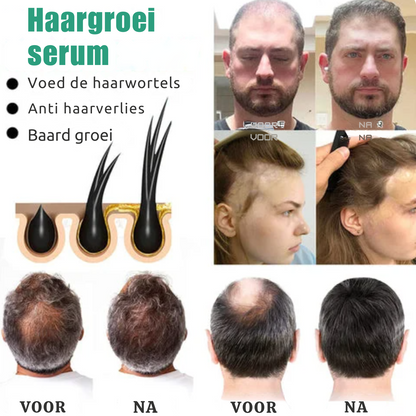 Vegan Haargroei serum - 1+1 Gratis!