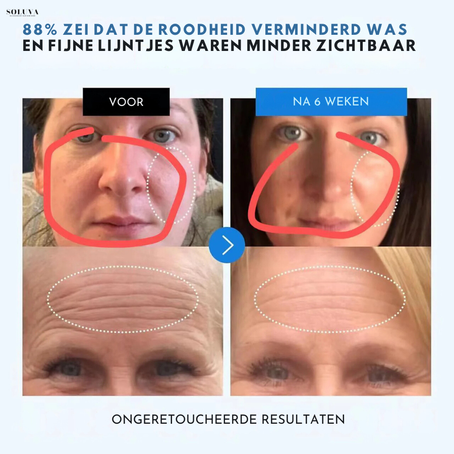 Alra Renewal Serum - hydraterende Anti-Aging Serum