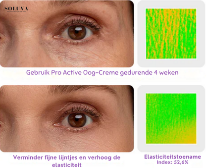 Pro Active Oog-Creme - 1+1 Gratis