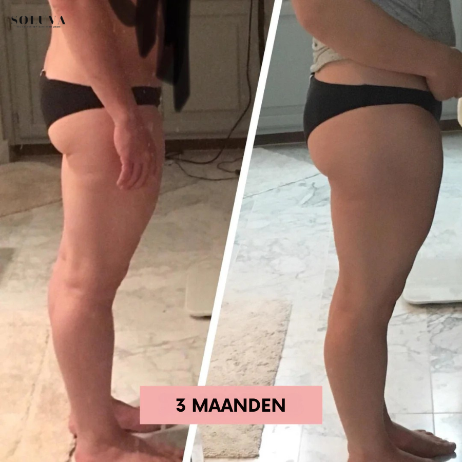 CurveLift -  De Sleutel tot Mooie Rondingen