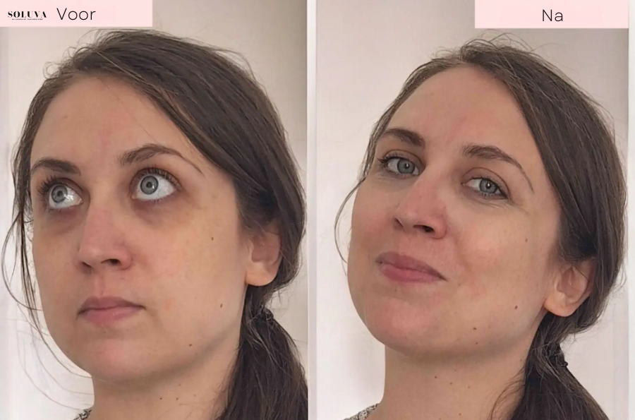 GlowLift - Oogverjongende Hersteltherapie