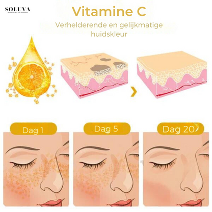 SkinShine - Huidverhelderende Gezichtsserum - 1+1 Gratis!