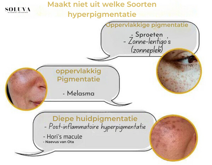 SkinShine - Huidverhelderende Gezichtsserum - 1+1 Gratis!