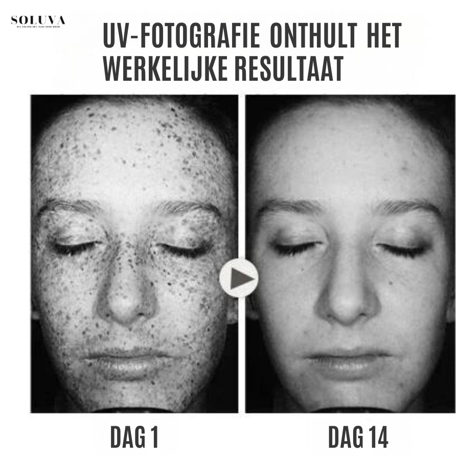 SkinShine - Huidverhelderende Gezichtsserum - 1+1 Gratis!