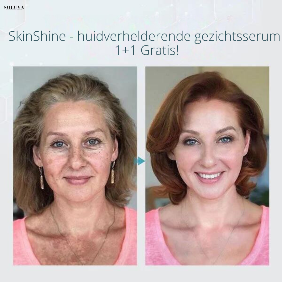 SkinShine - Huidverhelderende Gezichtsserum - 1+1 Gratis!