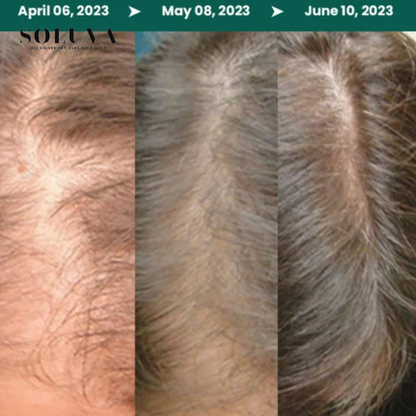 Vegan Haargroei serum - 1+1 Gratis!