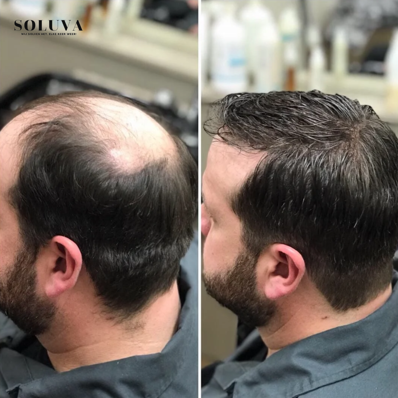 Vegan Haargroei serum - 1+1 Gratis!