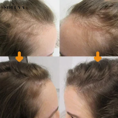 Vegan Haargroei serum - 1+1 Gratis!